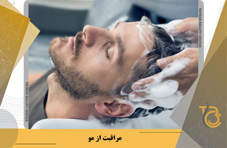 مراقبت از مو