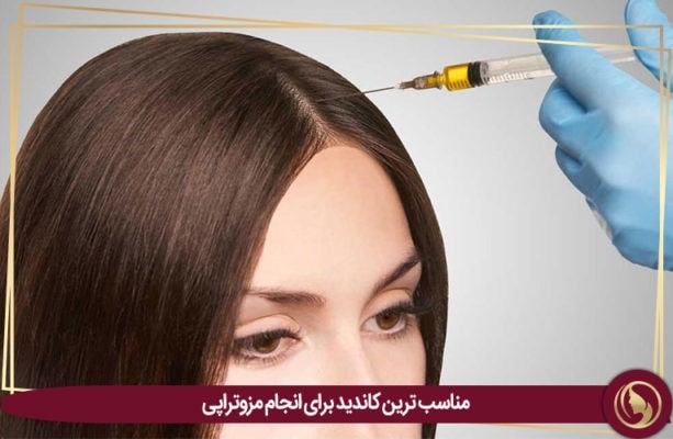 مزوتراپی مو