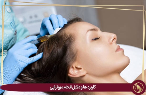 کاربرد مزوتراپی