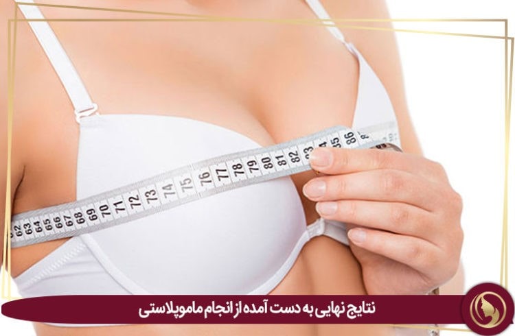 عمل ماموپلاستی