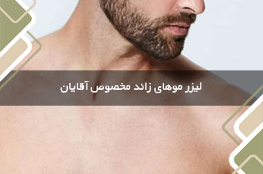 لیزر موهای زائد مخصوص آقایان