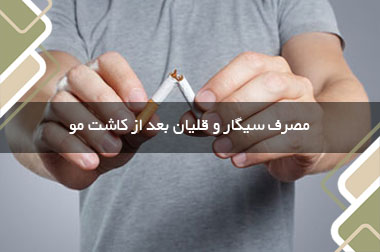 مصرف سیگار و قلیان بعد از کاشت مو