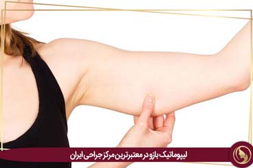 لیپوماتیک بازو در معتبرترین مرکز جراحی ایران