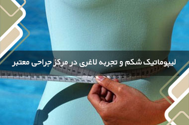 لیپوماتیک شکم و تجربه لاغری در مرکز جراحی معتبر