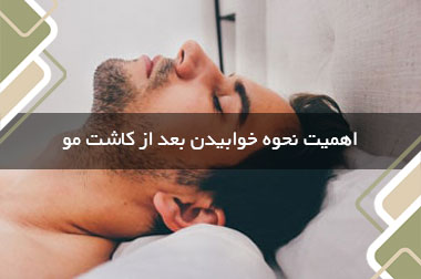 اهمیت نحوه خوابیدن بعد از کاشت مو