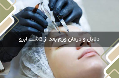 دلایل و درمان ورم بعد از کاشت ابرو