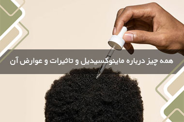 همه چیز درباره ماینوکسیدیل و تاثیرات و عوارض آن