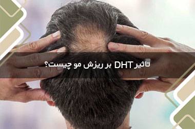 تاثیر DHT بر ریزش مو چیست؟