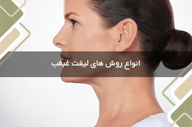 انواع روش های لیفت غبغب