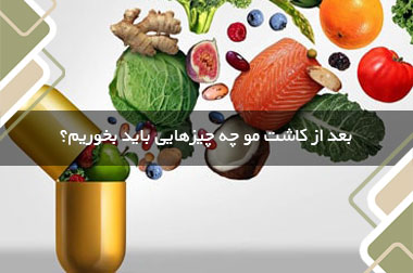 بعد از کاشت مو چه چیزهایی باید بخوریم؟