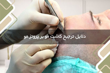 دلایل ترجیح کاشت مو بر پروتز مو