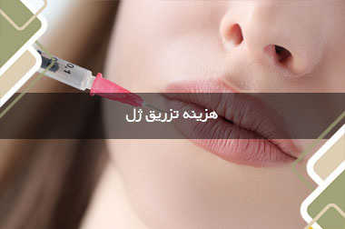 هزینه تزریق ژل