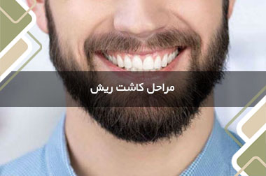 مراحل کاشت ریش