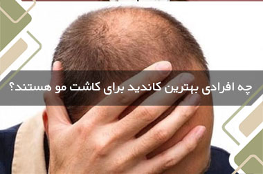 چه افرادی بهترین کاندید برای کاشت مو هستند؟