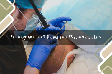 دلیل بی حسی کف سر پس از کاشت مو چیست؟