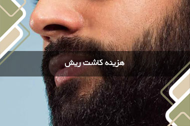 هزینه کاشت ریش