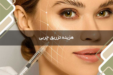 هزینه تزریق چربی