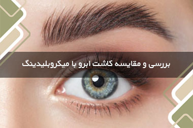 بررسی و مقایسه کاشت ابرو با میکروبلیدینگ