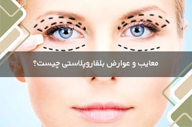 معایب و عوارض بلفاروپلاستی چیست؟