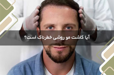 آیا کاشت مو روشی خطرناک است؟