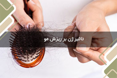 تاثیر ژن بر ریزش مو