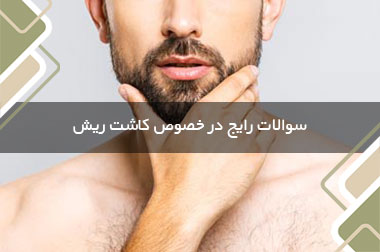 سوالات رایج در خصوص کاشت ریش