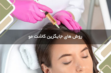 روش های جایگزین کاشت مو
