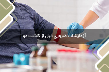 آزمایشات ضروری قبل از کاشت مو