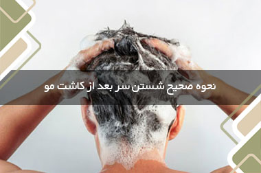 نحوه صحیح شستن سر بعد از کاشت مو