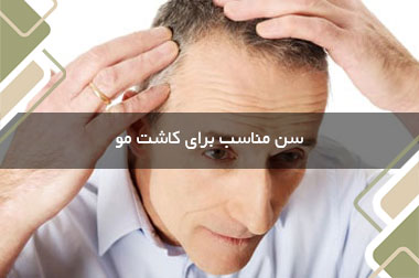 سن مناسب برای کاشت مو