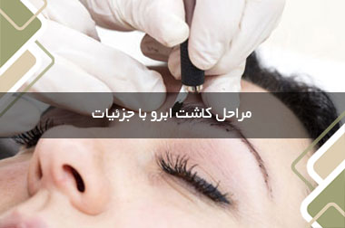 مراحل کاشت ابرو با جزئیات