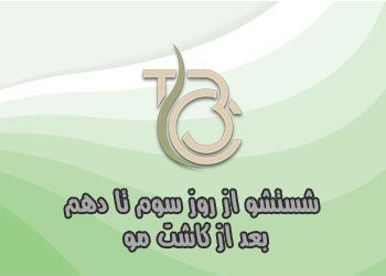 شستشوی روز سوم تا دهم بعد از کاشت مو