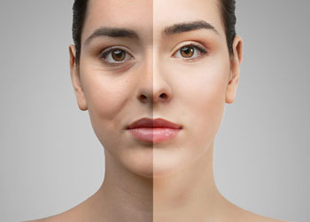 لیست مراقبت های بعد از بلفاروپلاستی