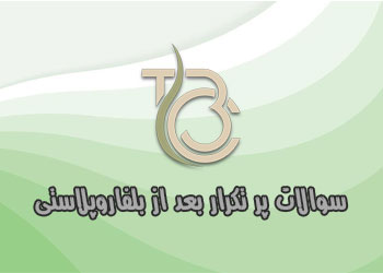 سوالات پر تکرار بعد از بلفاروپلاستی