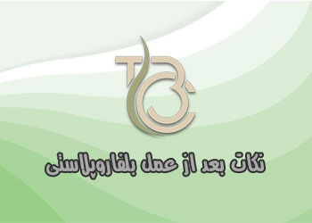 نکات بعد از عمل بلفاروپلاستی