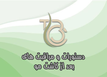 دستورات و مراقبت های بعد از کاشت مو